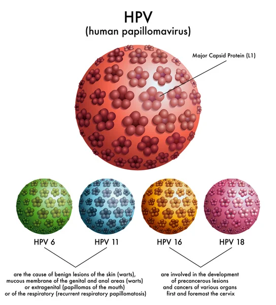 Papilloma a vírus gi HPV fertőzés tünetei férfiak esetében