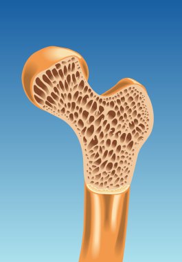 renkli Osteoporoz düzeni