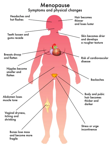 Colorido esquema de menopausia — Vector de stock