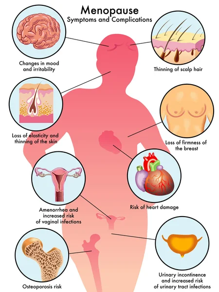 Esquema colorido Menopausa — Vetor de Stock