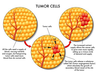 Tumor cells scheme