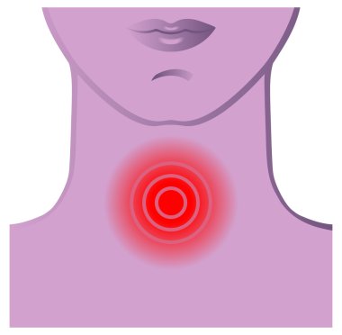 Boğaz etkilerini gösteren resim