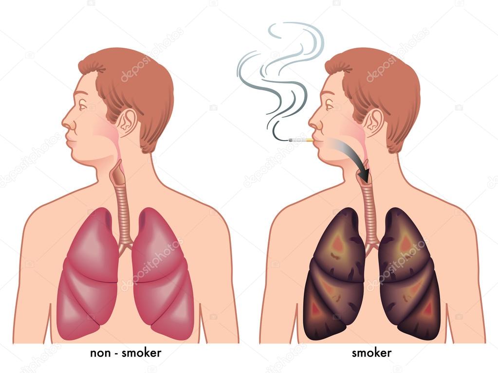Illustration of the effects of the smoke