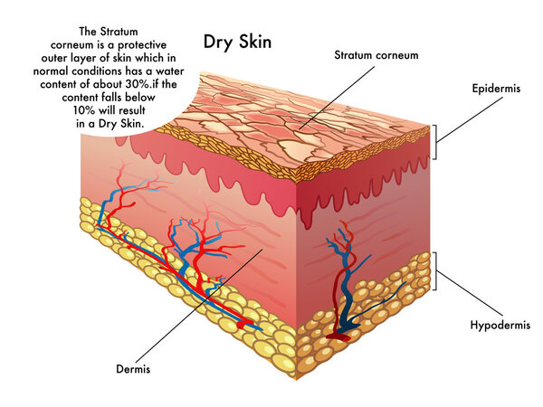 human dry skin
