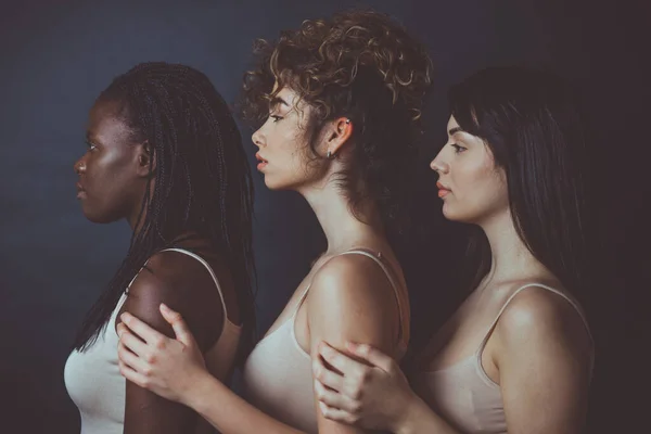 Drei Mädchen Verschiedener Ethnien Posieren Studio Für Eine Body Positivity — Stockfoto