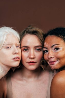 Farklı tür ten rengine sahip çok ırklı bir grup kadın stüdyoda birlikte poz veriyor. Vücut pozitifliği ve kendini kabullenme kavramı