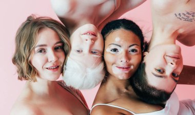 Farklı tür ten rengine sahip çok ırklı bir grup kadın stüdyoda birlikte poz veriyor. Vücut pozitifliği ve kendini kabullenme kavramı