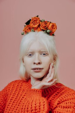 Stüdyoda poz veren albino bir kızın yaşam tarzı. Vücut pozitifliği, çeşitlilik ve moda kavramları