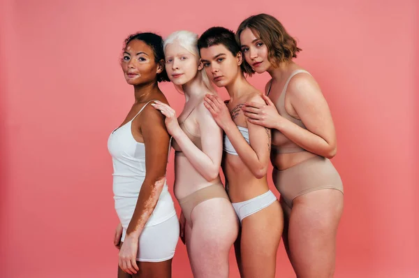 Grupo Mulheres Multiétnicas Com Diferentes Tipos Pele Posando Juntos Estúdio — Fotografia de Stock