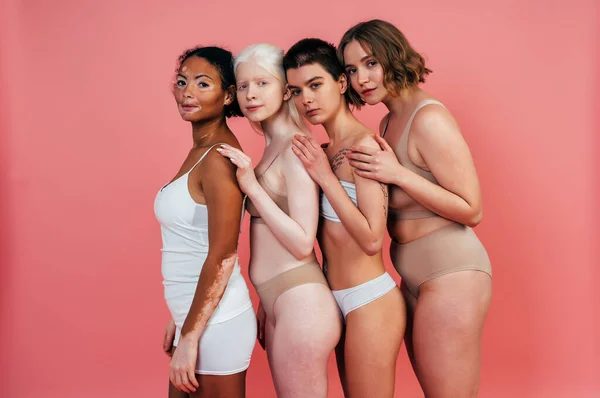 Group of multiethnic women with different kind of skin posing together in studio. Concept about body positivity and self acceptance