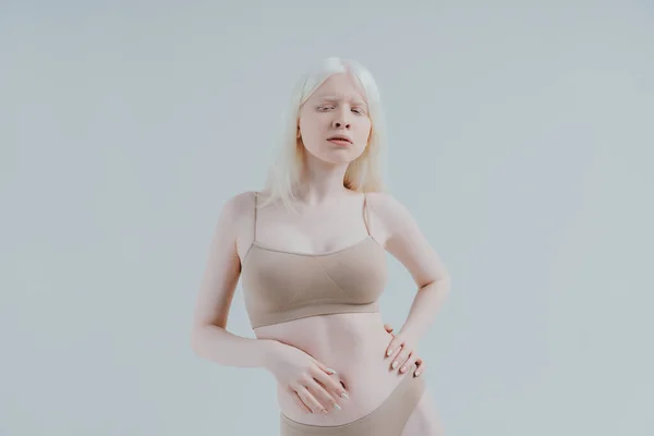 Image Beauté Une Fille Albinos Posant Studio Portant Lingerie Concept — Photo