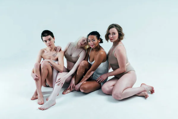 Group of multiethnic women with different kind of skin posing together in studio. Concept about body positivity and self acceptance