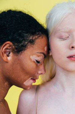 Farklı tür ten rengine sahip çok ırklı bir grup kadın stüdyoda birlikte poz veriyor. Vücut pozitifliği ve kendini kabullenme kavramı