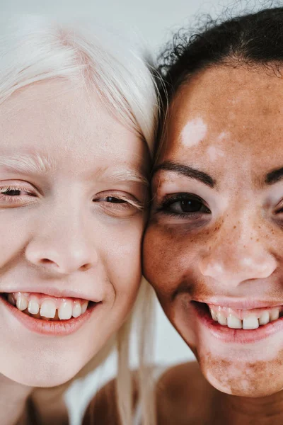 Ομάδα Πολυεθνικών Γυναικών Διαφορετικό Είδος Δέρματος Ποζάρουν Μαζί Στο Στούντιο — Φωτογραφία Αρχείου