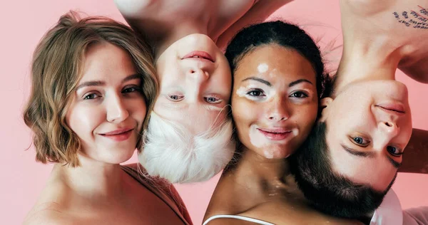 Group of multiethnic women with different kind of skin posing together in studio. Concept about body positivity and self acceptance