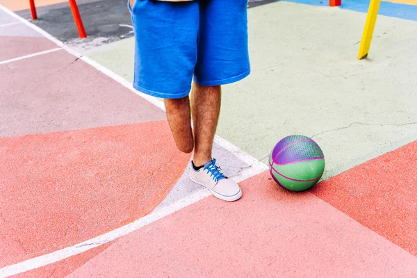 Amputierter Kleiner Junge Der Park Basketball Spielt Und Sport Treibt — Stockfoto