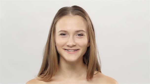 Mladá dívka ukazuje rovnátka na zuby. Bílá. Zpomalený pohyb — Stock video
