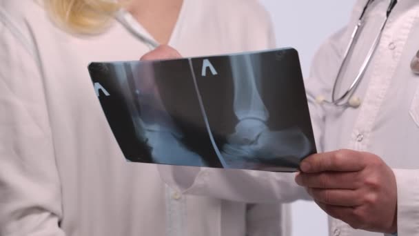 Senior doctor consults patient by showing her picture of leg and discusses treatment of disease with her. Patient listens doc in white medical suit. Close up. Slow motion. — Vídeo de Stock