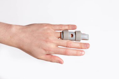 Erkek sol avuç içi kırık yüzük parmağıyla plastik bir sabitle kaplanmış.