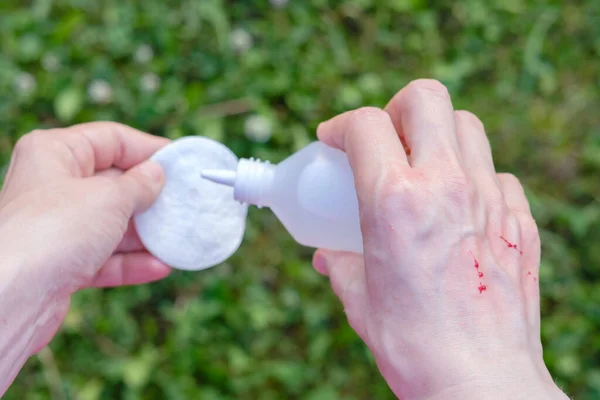 Tratar la mano con arañazos sangrientos de gato o arbusto al aire libre —  Fotos de Stock