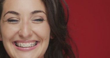 Diş tellerine göre diziliş. Neşeli genç bayan güler yüzlü ve güler yüzlü. Diş bakımı, ortodontik tedavi