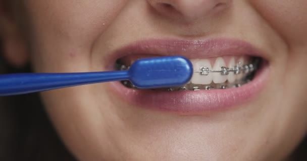 Hembra con frenos cepillarse los dientes con cepillo de dientes, primer plano. La chica mantiene sus dientes limpios. Higiene dental — Vídeos de Stock