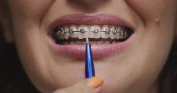 Cepillarse los dientes y frenos. Cerrar esmalte de limpieza femenina por cepillo de dientes ortodóncico. Higiene dental, estomatología — Vídeo de stock