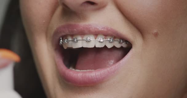 Nettoyage des dents et des orthèses. Gros plan de la cavité buccale de la femme en nettoyant le dentifrice en mousse. Hygiène dentaire — Video