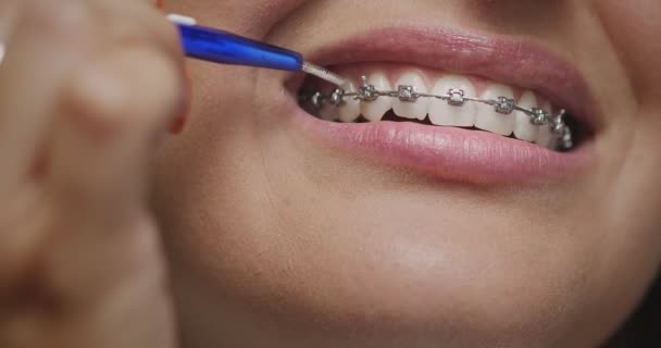 Dientes, aparatos de cepillado. Cerrar la limpieza interdental femenina con cepillo de dientes de ortodoncia. Higiene dental, odontología — Vídeos de Stock