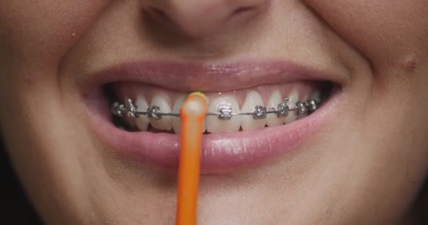 Βούρτσισμα δοντιών. Κοντινό πλάνο γυναίκα με τιράντες καθαρισμού σμάλτο από οδοντόβουρτσα. Οδοντιατρική υγιεινή, οδοντιατρική, ορθοδοντική περίθαλψη — Αρχείο Βίντεο
