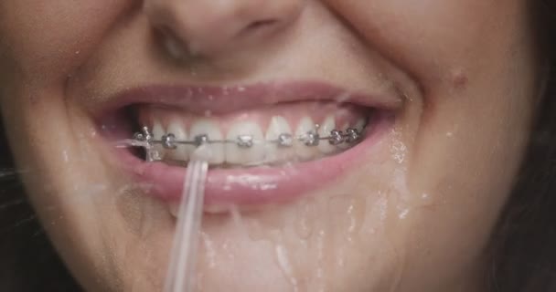 Alicate de agua, riego oral dental para el cuidado de los aparatos ortopédicos. Primer plano de la boca de limpieza femenina de la placa. Rutina de higiene dental — Vídeos de Stock