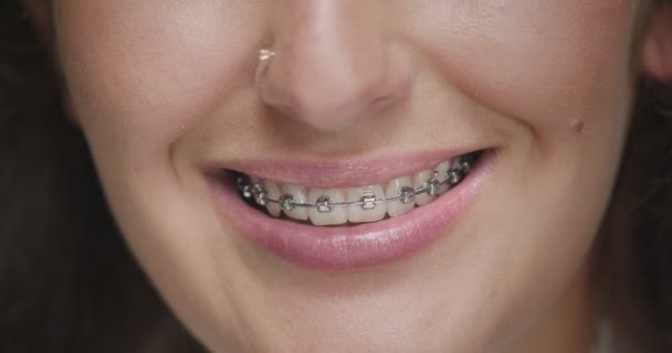 Frenos dentales. Cuidado dental. Tratamiento ortodóncico. Primer plano de una joven sonriente con una sonrisa hermosa y sincera — Vídeos de Stock