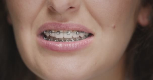 Alineación de los dientes por frenos. Primer plano de la boca de la mujer que habla. Cuidado dental, estomatología, odontología, tratamiento ortodóncico. — Vídeos de Stock