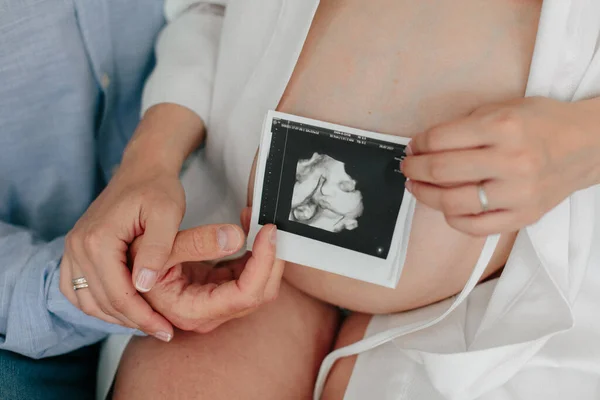 Çocuğun gelecekteki ultrasonunun fotoğrafını tutan genç bir çift. Hamilelik konsepti. Hamile bir kız. Genç ebeveynlerin elleri
