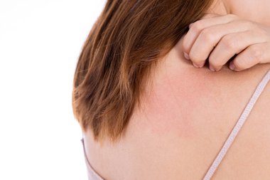 Sırtını kaşıyan bir kadın izole edilmiş beyaz bir arka plan. Reklam konsepti için tıbbi ve sağlık hizmeti.