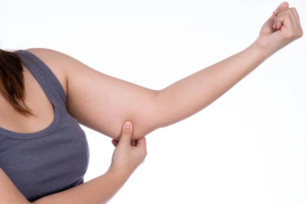 Vrouw Met Bovenmatige Dikke Arm Geïsoleerde Witte Achtergrond Vrouw Knijpen — Stockfoto