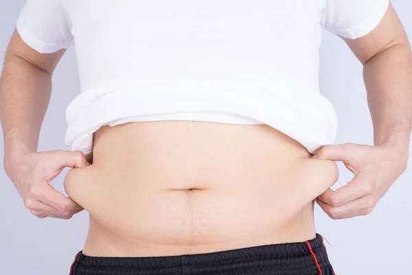 Tlustý Muž Drží Nadměrné Tlusté Břicho Tlusté Břicho Izolované Šedé — Stock fotografie