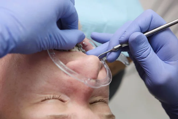 Installation Tandställning Tandklinik Oigenkännlig Läkare Korrigering Tänder Och Malocklusion Munnen — Stockfoto