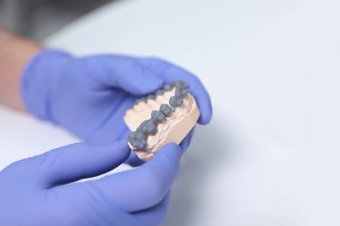 Kurulumdan önce diş telleri bir ortodontistin elinde. Dişlerinin yerleşimi. Sağlık kavramı. Ellerinizi koruyucu eldivenlere koyun. Beyaz arka planda fotoğraf. Üst görünüm.