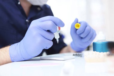 Diş hekimi diş teli takmak için bir şişe yapıştırıcı tutuyor. Diş izi ya da ısırık izi. Sağlık kavramı. Boşluğu kopyala.