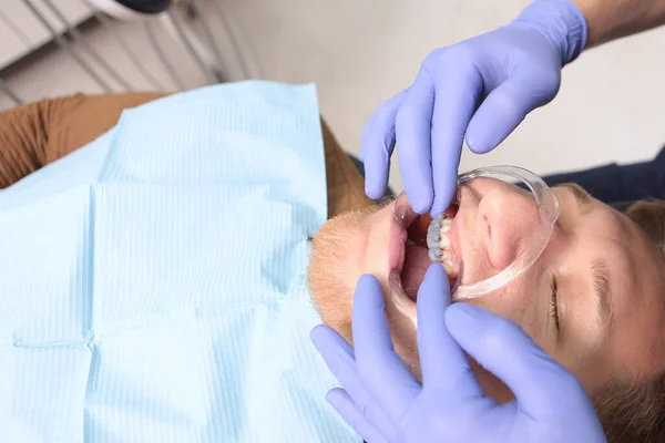 Installing Braces Upper Row Teeth Young Man Orthodontist Appointment Alignment — Stock Photo, Image