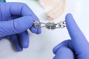 Bir doktorun ellerinde ortodontik diş telleri. Diş izi ya da ısırık izi. Tanımlanamayan kişi. Ellerinizi koruyucu eldivenlere koyun. Makro fotoğraf. Üst görünüm..