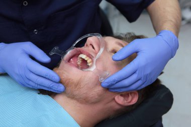 Diş hekimi ağız boşluğu için genişleticiyi yerleştirir. Tanımlanamayan doktor. Sağlık kavramı. Ellerinizi koruyucu eldivenlere koyun. Üst görünüm.