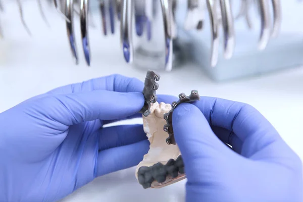 Doktor diş tellerini tutuyor. Dişlerinin yerleşimi. Sağlık kavramı. Dişler için yeni diş telleri. Ellerinizi koruyucu eldivenlere koyun. Beyaz arka planda fotoğraf. Üst görünüm.