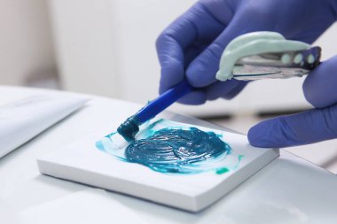 Diş hekimi hastanın dişlerinin kalıbını çıkarır. Güzellik ya da sağlık kavramı. Diş izleri için dişçi malzemesi. Ellerinizi koruyucu eldivenlere koyun. Tanımlanamayan kişi. Yan görünüm