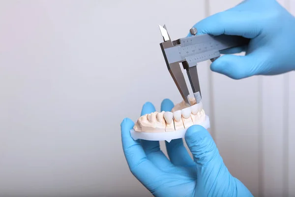 Técnico Dental Hace Medición Las Carillas Chapas Cerámica Compuestos Manos — Foto de Stock