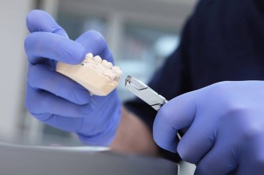 Diş tellerinin yerleştirilmesi. Bir ortodontist parantez üzerinde dener. Bileklik. Dişlerin dizilişi bir doktorun ellerinde. Maloklasyon ya da dişçilik düzeltmesi. Koruyucu eldivenler giymiş tanınmayan bir adam. Makro fotoğraf.