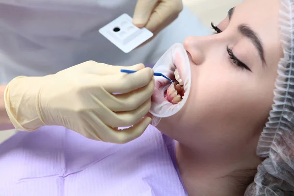 歯医者は若い患者の歯に対照ゲルを適用する。口腔の専門衛生。キャリーと歯周病の予防.健康保護の概念. — ストック写真