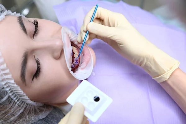 Preparation Oral Cavity Professional Teeth Cleaning Dentist Applies Purple Gel — Stock Photo, Image