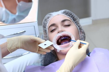 Diş hekimi, profesyonel diş temizliğinden önce hastanın dişlerine mor jel sürer. Dişeti ve sakız hastalıklarının önlenmesi. Ellerinizi koruyucu eldivenlere koyun. Üst görünüm.